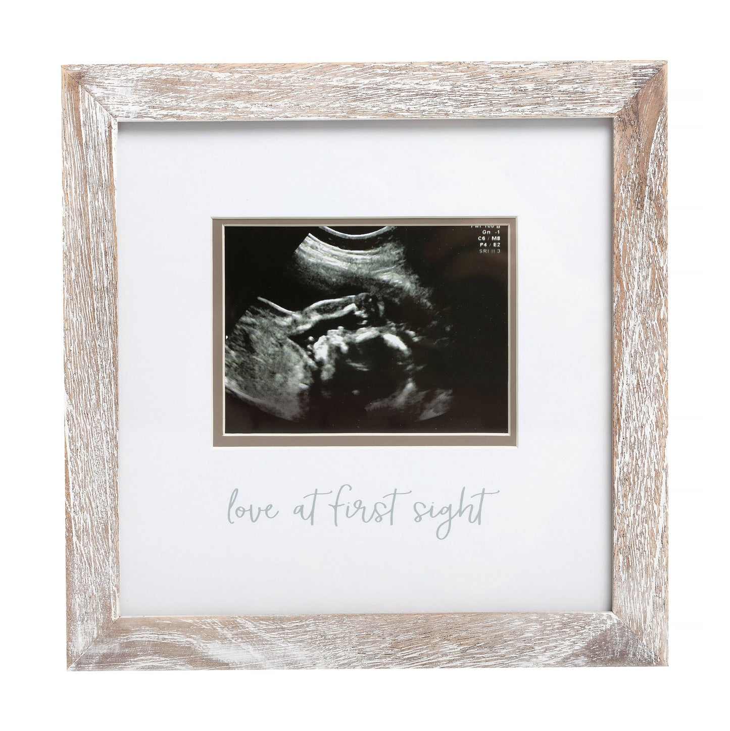 Rustic Sonogram Photo Frame